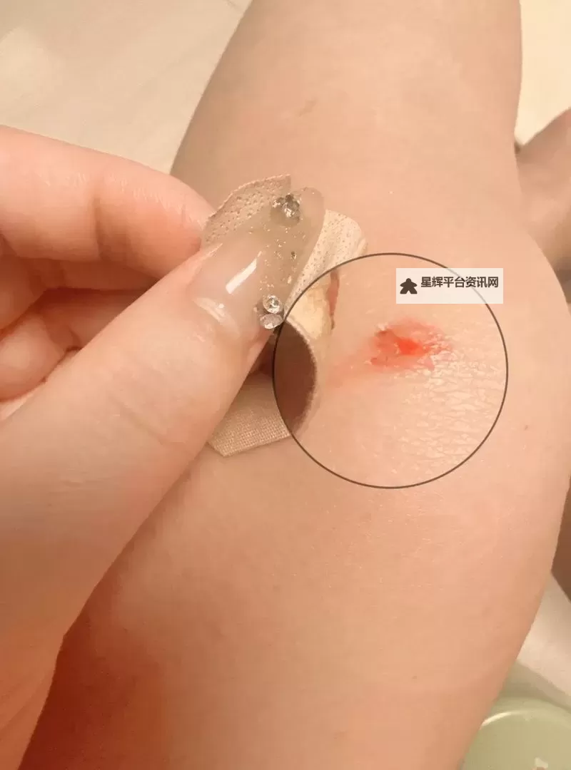 真人实拍女处破出血的注意事项：安全防护与应急处理指南图1