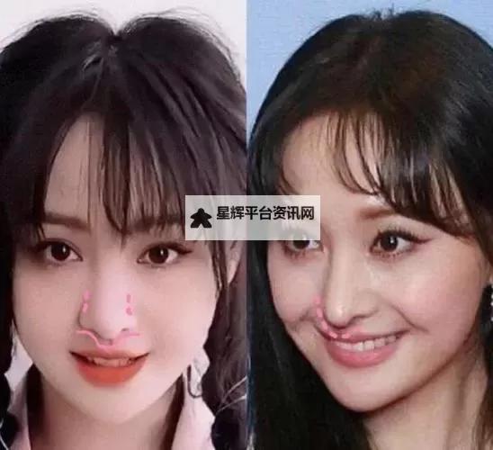 郑爽承认整容视频传闻持续发酵：网友热议真相与影响图1